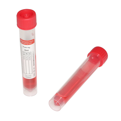 Διαγνωστικό μίας χρήσης PCR μόνο - φορητή 150mm δοκιμής πατσαβούρα εξαρτήσεων