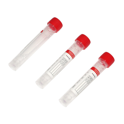 SGS PCR έγκρισης γρήγορη εξάρτηση εξαγωγής RNA εξαρτήσεων δοκιμής για την εξαγωγή covid-19