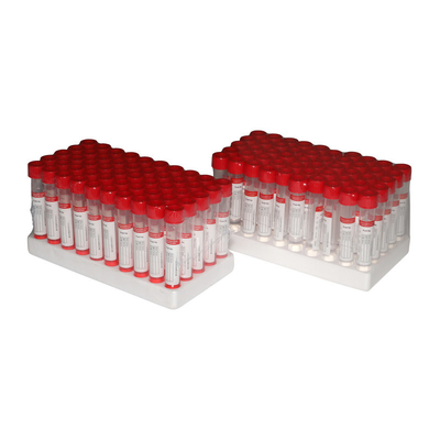 5ml ιατρικός μίας χρήσης σωλήνας αποθήκευσης δειγμάτων εξαρτήσεων VTM με την πατσαβούρα