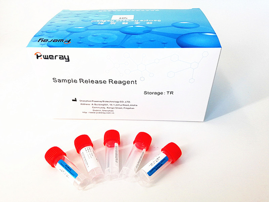 Ρινική PCR δειγμάτων μίνι εξάρτηση RNA ανίχνευσης προερχόμενη από ιό με το ISO 13485